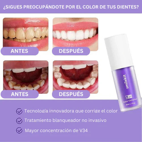 Hismile Blanqueador Dental (2025) ⭐⭐⭐⭐⭐